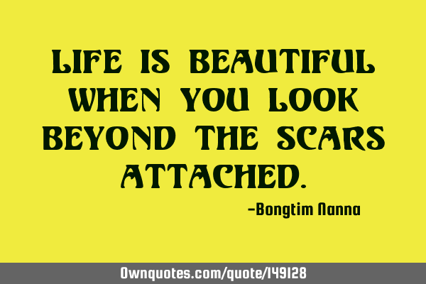 Life is beautiful when you look beyond the scars