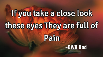 If you take a close look these eyes They are full of Pain