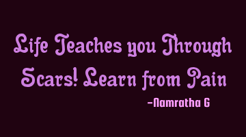 Life Teaches you Through Scars! Learn from Pain