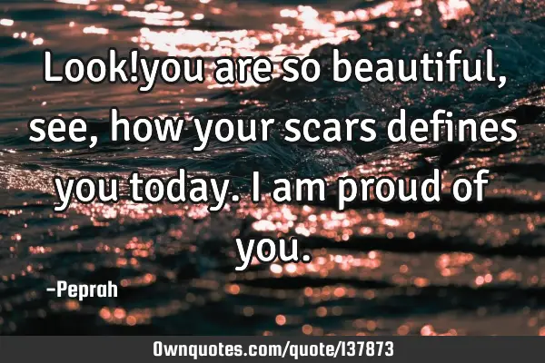 Look!you are so beautiful,see, how your scars defines you today.i am proud of